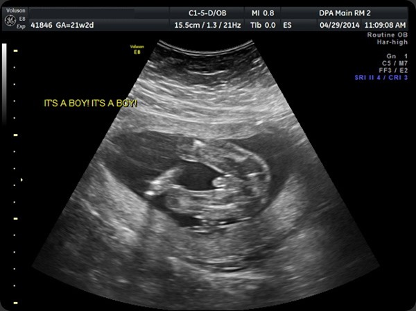 Ultrasound for a baby boy