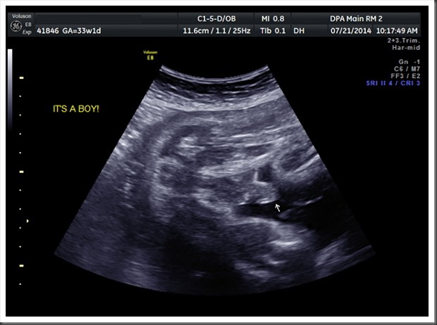 Baby Boy Ultrasound at 33.1 weeks